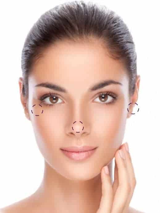 Lifting facial - Dr. Junco Cirugía plástica y estética